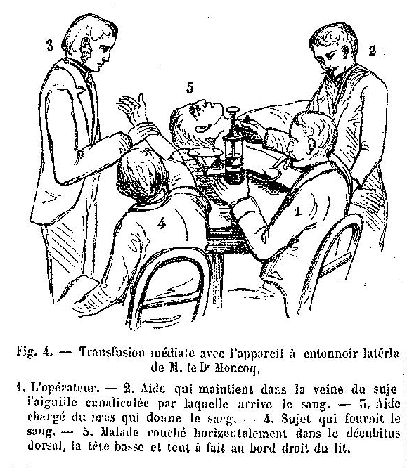 Histoire de la transfusion à travers les images (II)