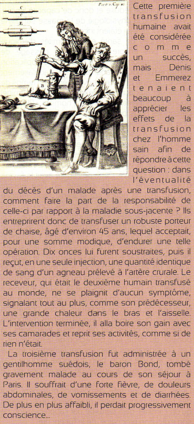 Les première transfusions sanguines ont eu lieu sous Louis XIV