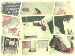 la transfusion du sang conservé 1938